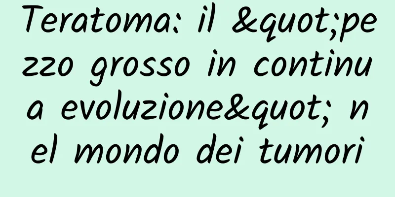Teratoma: il "pezzo grosso in continua evoluzione" nel mondo dei tumori