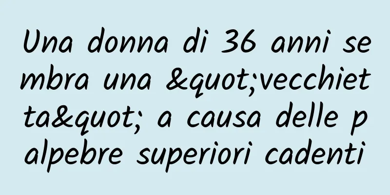 Una donna di 36 anni sembra una "vecchietta" a causa delle palpebre superiori cadenti