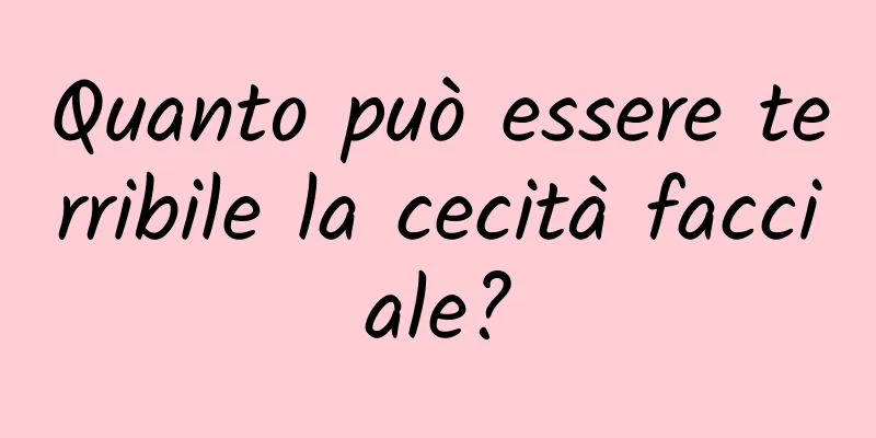 Quanto può essere terribile la cecità facciale?