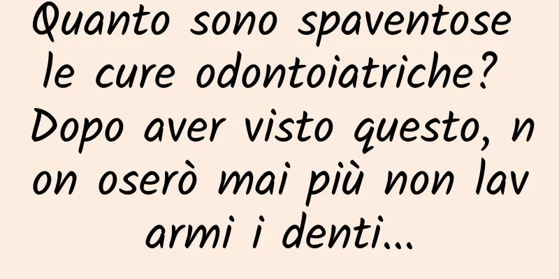 Quanto sono spaventose le cure odontoiatriche? Dopo aver visto questo, non oserò mai più non lavarmi i denti...