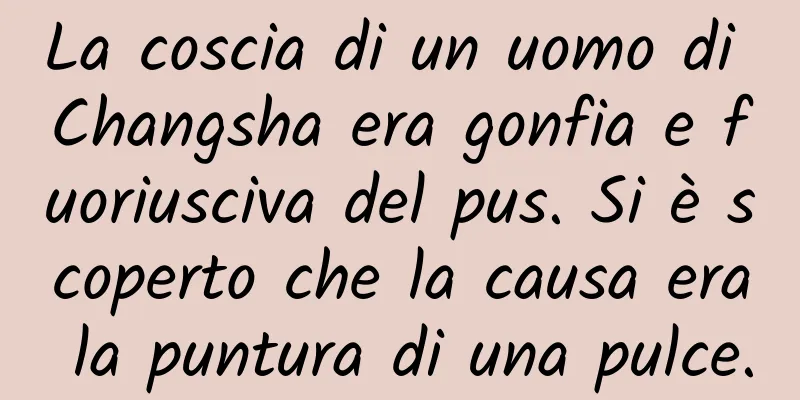 La coscia di un uomo di Changsha era gonfia e fuoriusciva del pus. Si è scoperto che la causa era la puntura di una pulce.